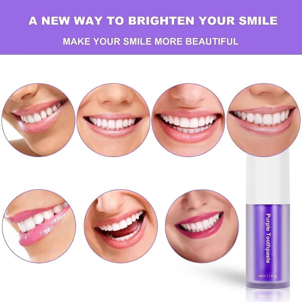 Teeth Whitening Color